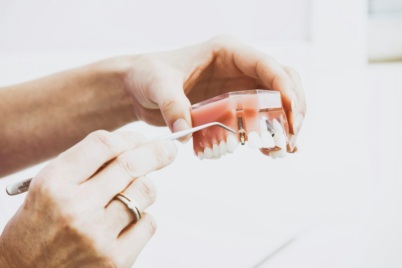 Hand holding a denture model