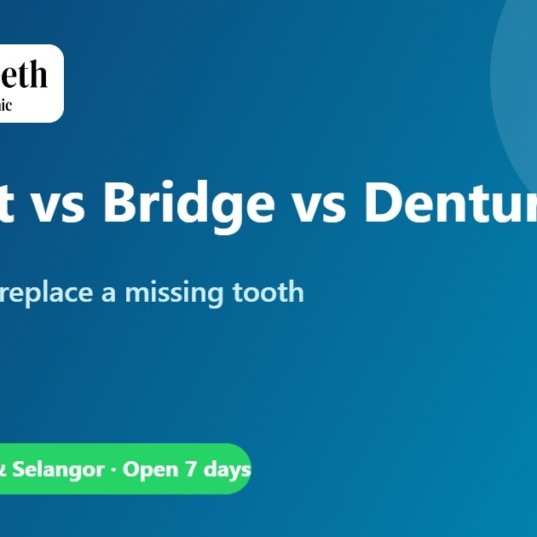 Missing a Tooth? Implant vs Bridge vs Denture Compared – Qualiteeth Dental Clinic